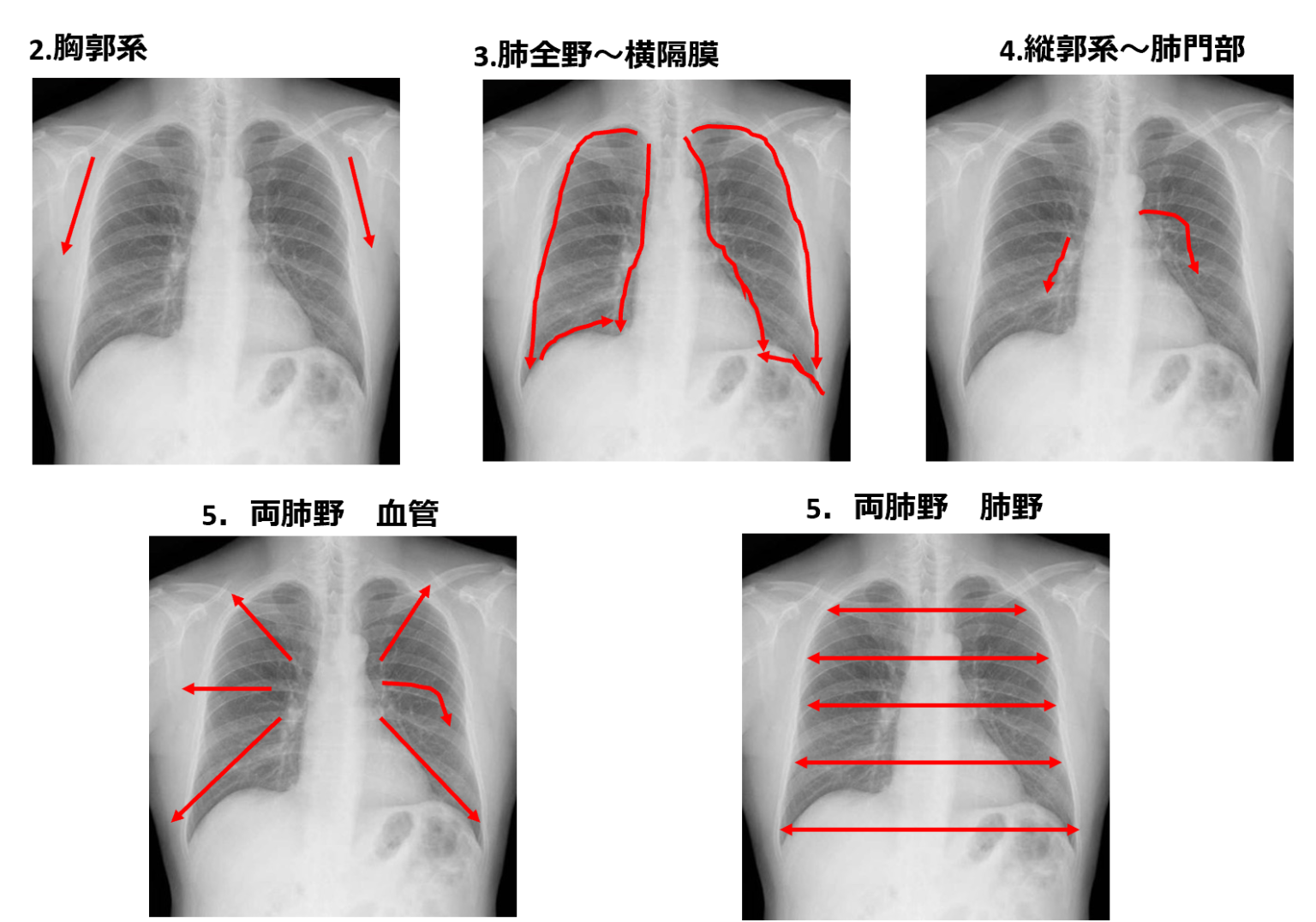 肋骨化骨とは | 肋骨の解剖図 – TYZD
